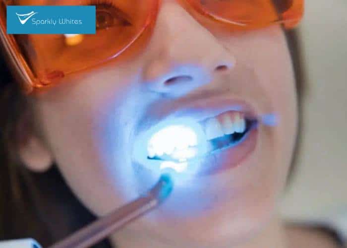 Is One Whitening Method Safer for Crowns, Fillings, or Dental Work Stoke?